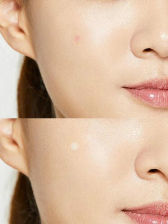 Cosrx Acne Pimple Master Patch 24τμχ