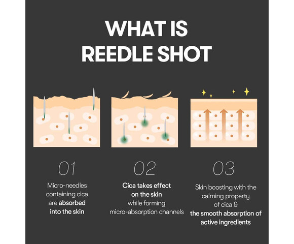 Vt Cosmetics Reedle Shot 300 50ml Εντατικός Ενισχυτής Ενδυνάμωσης