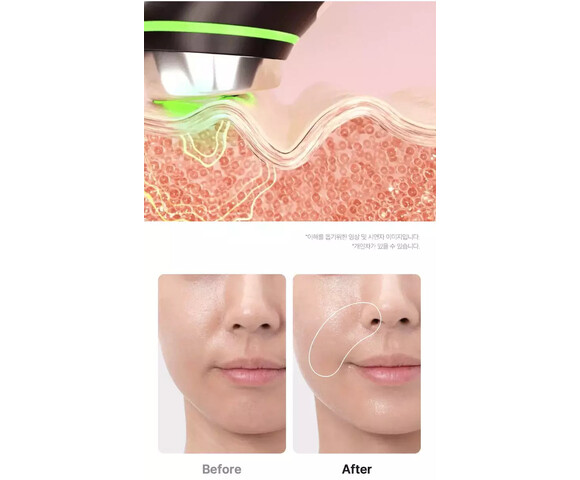 Medicube Age-R Booster Pro Pink