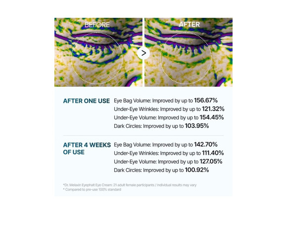 Dr.Melaxin Eyephalt Eyebag Cream- Κρέμα ματιών με αποτέλεσμα lifting