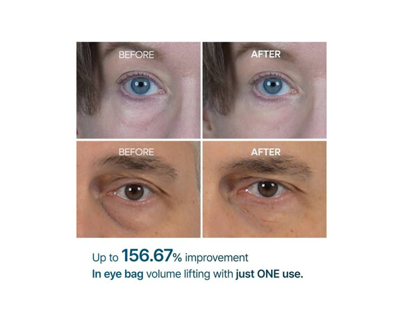 Dr.Melaxin Eyephalt Eyebag Cream- Κρέμα ματιών με αποτέλεσμα lifting