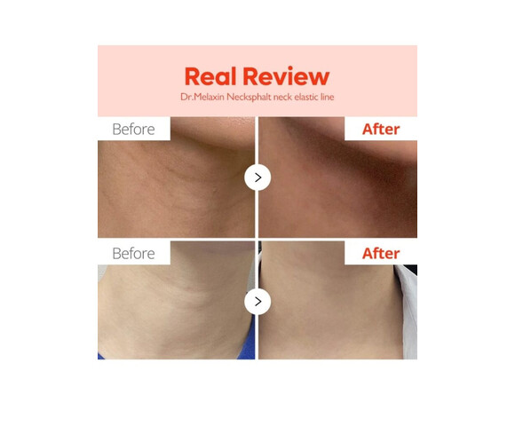 Dr.Melaxin Necksphalt ECM Ceramide Neck Cream- Κρέμα Λαιμού για Αντιγήρανση & Σύσφιξη 50ml