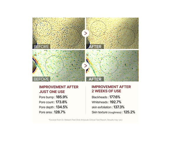Dr.Melaxin Peel Shot Exfoliating White Rice Ampoule- Peeling Προσώπου με ρύζι για Ευαίσθητες Επιδερμίδες 80ml