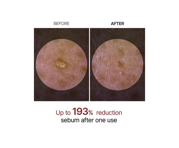 Dr.Melaxin Peel Shot Exfoliating White Rice Ampoule- Peeling Προσώπου με ρύζι για Ευαίσθητες Επιδερμίδες 80ml