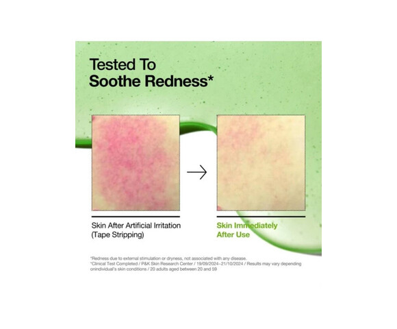 Anua Azelaic Acid 10 Hyaluron Καταπραϋντικό & Ενυδατικό Serum Προσώπου με Centella Asiatica & Νιασιναμίδη 30ml