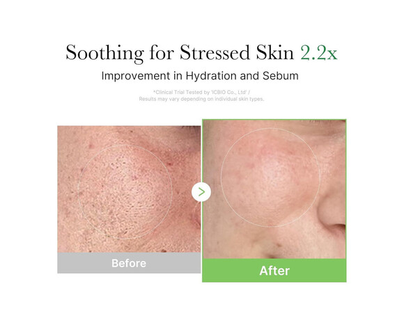 Medicube Exosome Cica Ενυδατική Κρέμα Προσώπου με Centella Asiatica 50ml