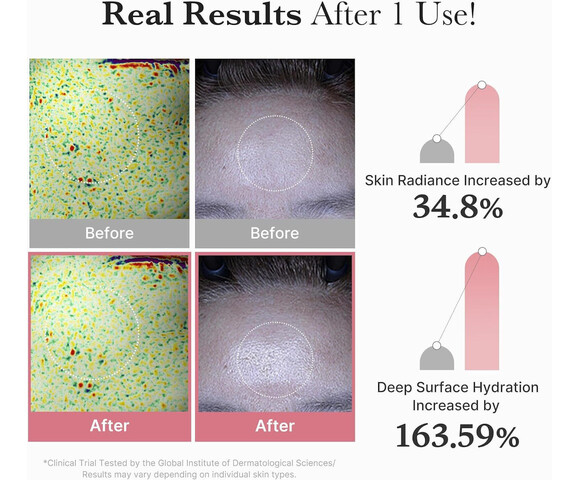 Medicube Pdrn Μάσκα Ομορφιάς Προσώπου για Λάμψη 22gr