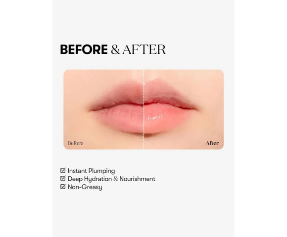 VT Reedle Shot Lip Plumper Expert- Gloss με μικροβελόνες και εφέ όγκου