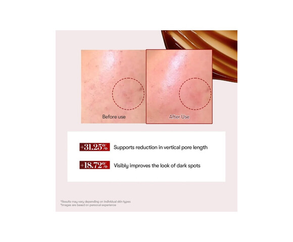 VT Cosmetics Red Booster Reedle shot 100 - Premium αντιρυτιδική και αναπλαστική φροντίδα με τεχνολογία Reedle Shot 50ml