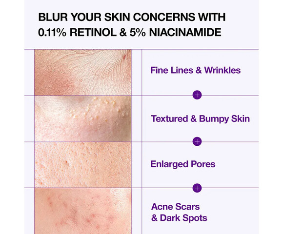 Anua Retinol 0.3% + Niacin Renewing Serum – Ορός με ρετινόλη & νιασιναμίδη για νεανική επιδερμίδα 30ml