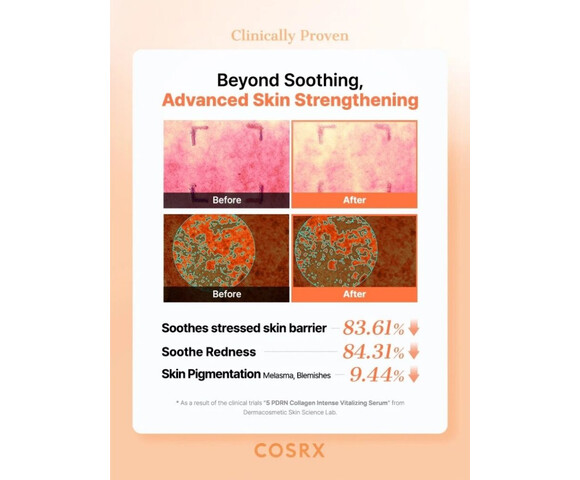 COSRX 5 PDRN Collagen Intense Vitalizing Serum – Συσφικτικός ορός αντιγήρανσης - ανάπλασης - λάμψης 100ml