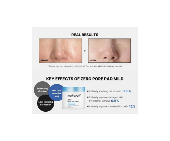Medicube Zero Pore Pad Mild - Pads Τόνωσης Προσώπου για Ευαίσθητες Επιδερμίδες 70τμχ