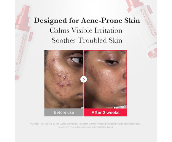 Medicube Hypochlorous Acid Daily Facial Spray - Mist Toner Απολέπισης Με Υποχλωριώδες Οξύ 8800289461880