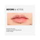 VT Reedle Shot Lip Plumper Beginner- Gloss με μικροβελόνες και εφέ όγκου