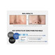 Medicube Zero Pore Pad Mild - Pads Τόνωσης Προσώπου για Ευαίσθητες Επιδερμίδες 70τμχ